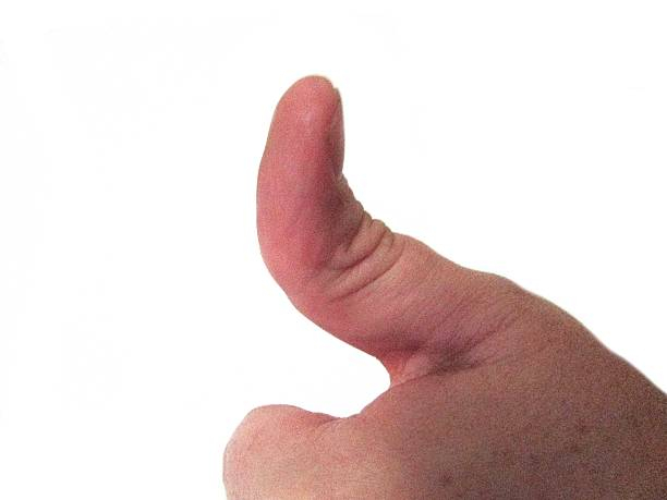 Unusual Thumb